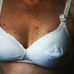 Neck Cancer Surgery May Disrupt Brain Drainage and Cognition - Neuroscience News