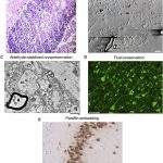 Mitochondria in the Brain’s Reward Hub Drive Nicotine Dependence - Neuroscience News