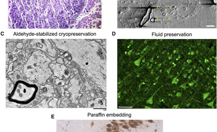 Mitochondria in the Brain’s Reward Hub Drive Nicotine Dependence - Neuroscience News