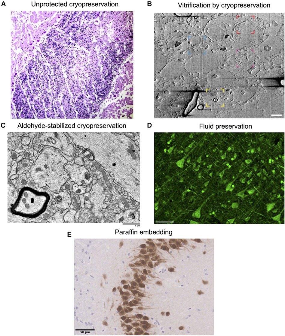 Mitochondria in the Brain’s Reward Hub Drive Nicotine Dependence - Neuroscience News